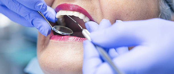 Teeth Whitening in IL